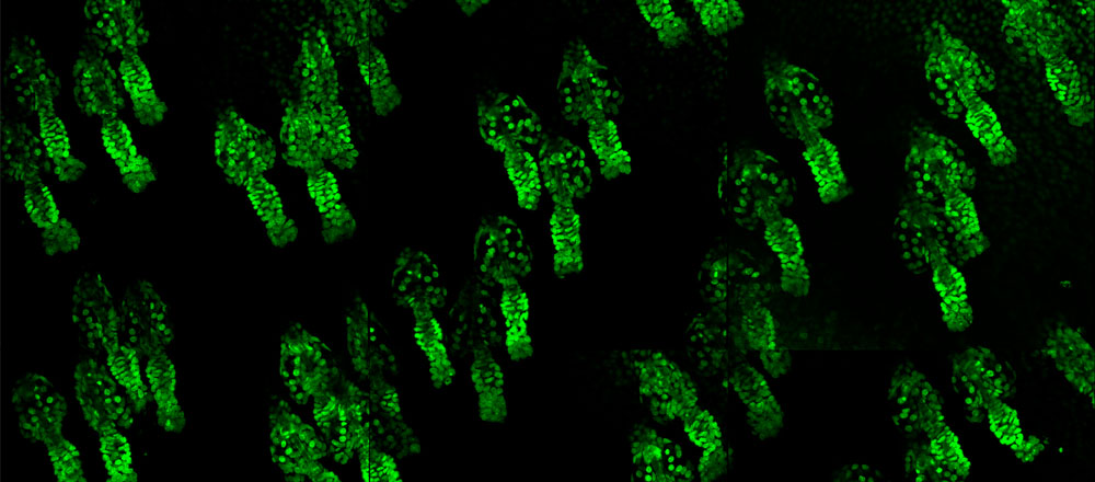 A field of live hair follicles